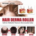 thumbnail image 4 of Stain Remover Spray, 300ML Stain Treater for Laundry, Stain Treater Spray, 4 of 5