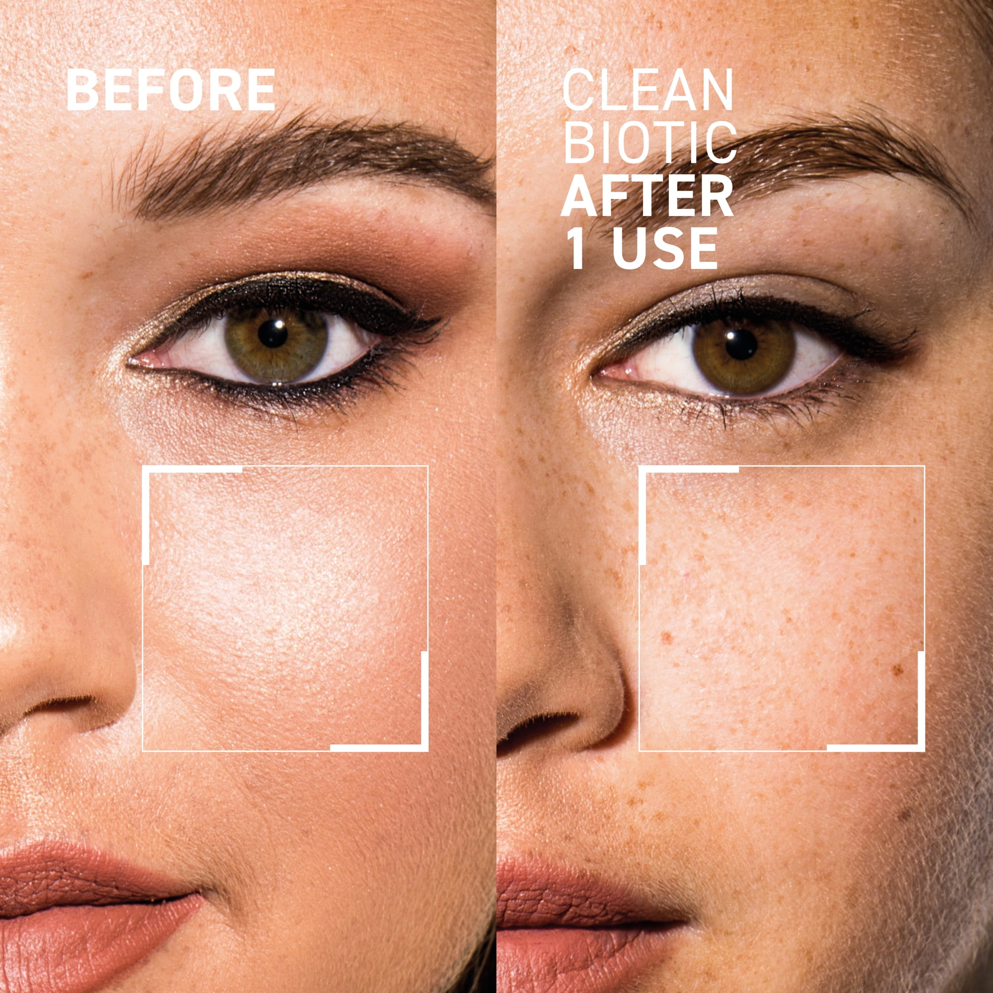 Dr. Brandt Clean Biotic - Removes Dirt, Impurities, Pollution, Makeup and Excess Oil 105ml