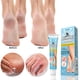 thumbnail image 1 of Hand And Foot Chapped Cream Dry Cracking Anticracking Cream 20g, 1 of 6