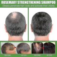 thumbnail image 4 of Eelhoe Rosemary Shampoo Deep Cleansing Massage Scalp Moisturizing Soft Thick Conditioning Shampoo -8440963343172, 4 of 4