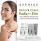 thumbnail image 5 of Kit de tratamiento para el acné Exposed Skin Care con limpiador facial, 5 of 6