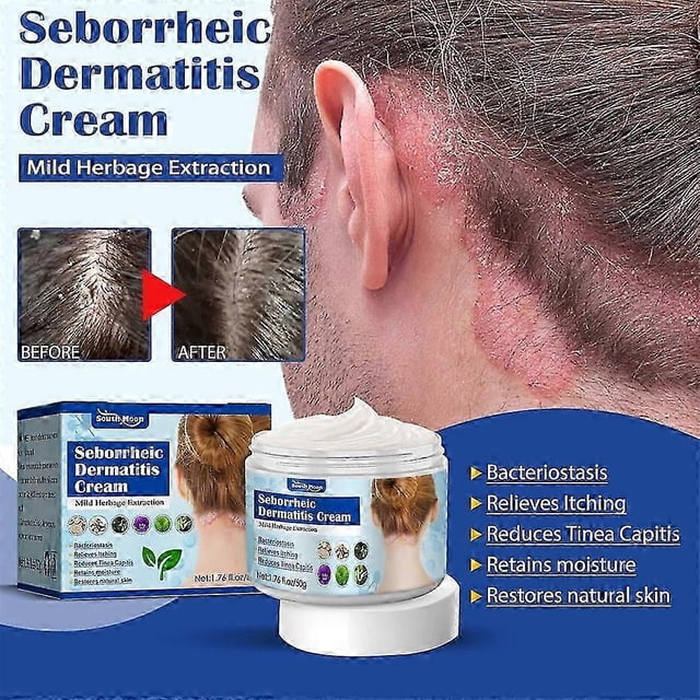 Seborrheic Dermatitis Cream, Psoriasis Anti-itch Cream, Soothing Moisturizer, for Psoriasis, Folliculitis, etc