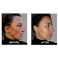 thumbnail image 5 of SkinSanity Clear Skin Results Regimen - All Natural Acne Treatment, 5 of 12