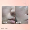 thumbnail image 5 of Crema hidratante facial antienvejecimiento Berayouth con células madre vegetales que ayuda a reducir las arrugas Ingredientes naturales Sin crueldad por LEudine, 5 of 5
