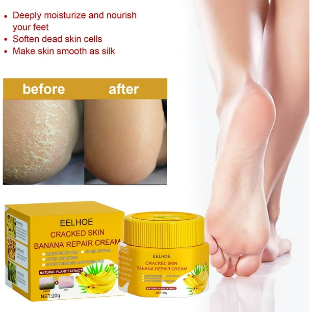 Crema reparadora para el cuidado de manos y pies Crema reparadora de plátano para piel agrietada, Crema para pies saludables para pies extremadamente secos y agrietados, 20 g kaili Sencillez