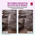 thumbnail image 5 of Taro Minoxidil for Women 5% Topical Aerosol Foam - Clinically Proven Hair Growth Solution - 2.11 Oz (2 Months Supply) - Minoxidil Foam for Women, Hair Thinning Treatment, 5 of 5