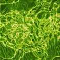 thumbnail image 1 of Ahgly Company Machine Washable Indoor Square Transitional Forest Green Area Rugs, 5' Square, 1 of 7