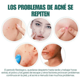 thumbnail image 4 of 112 Star-parches Invisibles UNIVERSOENLINEA.COM Eliminar Acne Estrella Granos, 4 of 9