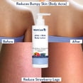 thumbnail image 4 of Holistic Body Lotion - Smooths Rough & Bumpy Skin - Glycolic & Lactic Acid Body Lotion with Niacinamide - 200 Ml, 4 of 6