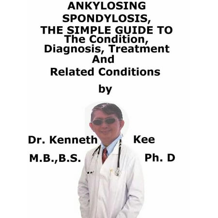Ankylosing Spondylitis, A Simple Guide To The Condition, Diagnosis, Treatment And Related Conditions - (Best Diet For Ankylosing Spondylitis)