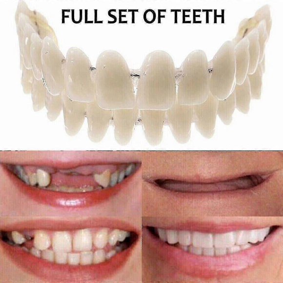 False Teeth Upper Lower Dental Veneers Dentures Tooth Cover Set LOV