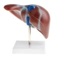 thumbnail image 2 of Modelo 1: 1 Lifesize Human Noraml Liver Lobule Gallbladder Con Base, Herramienta De Visualización De Enseñanza Escolar, Kits De Ciencia De Suministros, 2 of 8