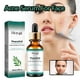 thumbnail image 5 of Ganfancp Hoygi Serum Reductor de Poros Mejora La Textura General de La Piel 30Ml Rebajas Flash Deals 1* Suero, 5 of 7