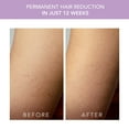 thumbnail image 6 of FOREO PEACH 2 go Lavander, 6 of 7