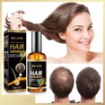 thumbnail image 2 of El sérum para el crecimiento del cabello HUOGUO 30 ml promueve el crecimiento del cabello más grueso, 2 of 5