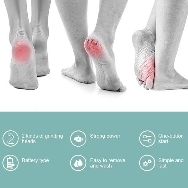 AMONIDA Electric Callus Remover, Foot Grinder, Rechargeable For Using At Home Traveling In The Office