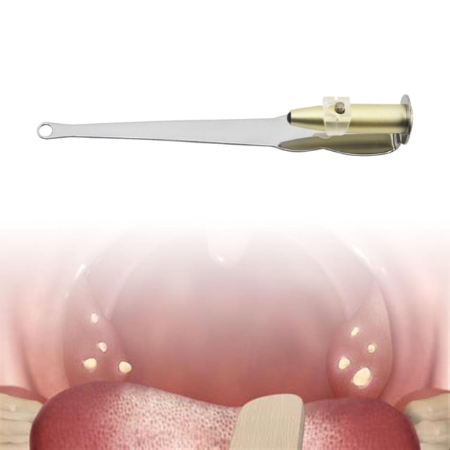 Herramienta De Succión De Piedra De Amígdala Removedor De Piedra De Amígdala De Cerumen Para Adultos De Viaje En Casa