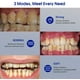 thumbnail image 3 of Raspador de dientes eléctrico - negro (caja azul neutral inglesa) Xemadio WRMH-1603, 3 of 9
