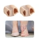 thumbnail image 5 of de 2 separadores de para juanetes, corrector de juanetes, tubo ligero para hombres y mujeres S 3x1.5x2cm shamjiam Enderezador de dedos, 5 of 9