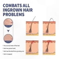 thumbnail image 3 of Post-Shave Roll-On for Men Ingrown Hair & Skin Irritation Relief Solution, 3 of 5