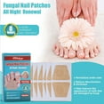 Nail Treatment Patch Anti Fungal Nail Correction Stickers Ingrown