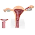 thumbnail image 2 of Removable 2 Parts 1:1 Human Female Uterus Ovary Vagina Anatomical Model, 2 of 5