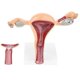 thumbnail image 2 of Removable 2 Parts 1:1 Human Female Uterus Ovary Vagina Anatomical Model, 2 of 5