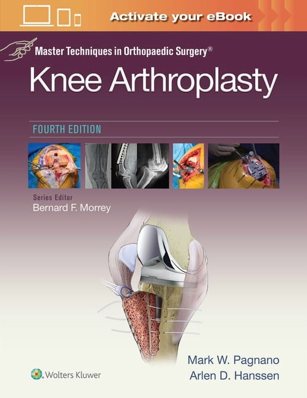Sarrafian's Anatomy of the Foot and Ankle: Descriptive