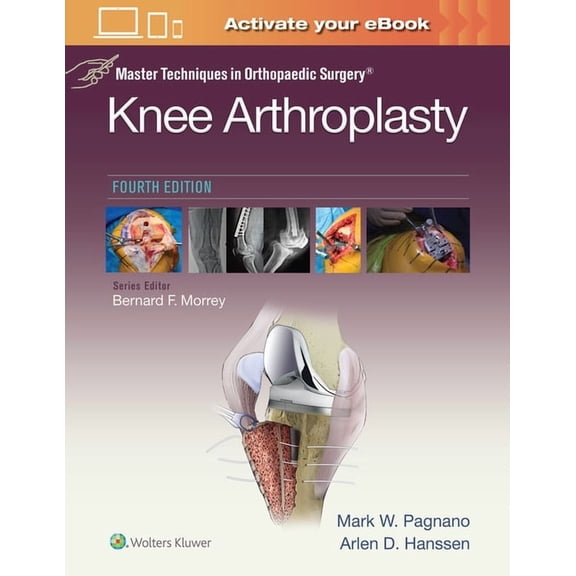 Master Techniques in Orthopaedic Surgery Master Techniques in Orthopedic Surgery: Knee Arthroplasty, (Hardcover)