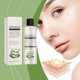 thumbnail image 5 of Cuidado Personal, Tónico, Tónicos, Serum Exfoliante Eau Exfoliation Douce Nettoyage En Profondeur Peau Hydratante Aloe Veras Apaisant Lissant Tonique Pour Le Visage 100ml, Eau essentielle, 5 of 9