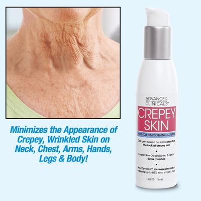 Crepey Skin Repair Treatment Cream - Walmart.com