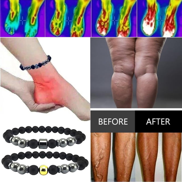 Tobillera De Obsidiana Negra Antihinchazón De 5 Uds., Pulsera De Terapia Magnética, Tobillera Magnética Ajustable Para Pérdida De Peso Para Hombres Y Mujeres, Regalos ANGGREK Anti Swelling Black Obsidian Anklet