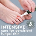 thumbnail image 4 of Tea Tree Oil Antifungal Foot Gel | Relieves Jock Itch, Athlete’s Foot & Ringworm | Soothes Itching & Burning | Moisturizes Dry, Cracked Feet | No-Touch Applicator | 1-Week Treatment Option | 20g, 4 of 8