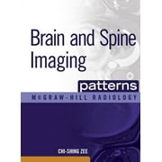 CHI-SHING ZEE McGraw-Hill Radiology: Brain and Spine Imaging Patterns: Brain & Spine Imaging (Hardcover)