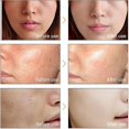 thumbnail image 2 of Belita Amy, suero facial blanqueador con vitamina C, aclara las manchas, aclara la esencia de la piel Facial, destiñe las manchas oscuras, elimina las pecas y el cuidado de las manchas kaili Sencillez, 2 of 5