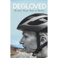 thumbnail image 1 of Pre-Owned Degloved: Every Scar has a Story (Paperback) 1913615057 9781913615055, 1 of 1