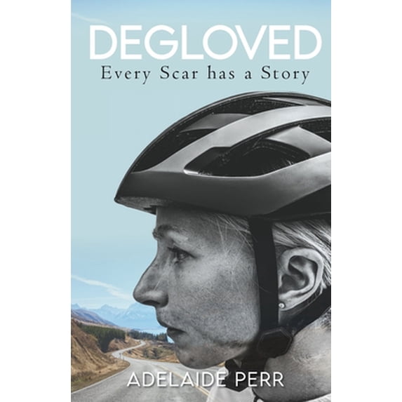 Pre-Owned Degloved: Every Scar has a Story (Paperback) 1913615057 9781913615055