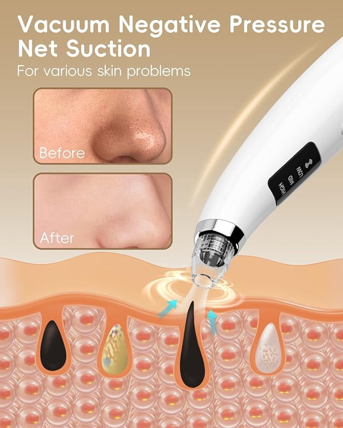 Facial Pore Blackhead Remover Vacuum - Face Cleaner and Blackhead Extractor with 3 Adjustable Suction Levels, 5Replaceable Tips - Pore Vacuum Kit for Women&Men (White)