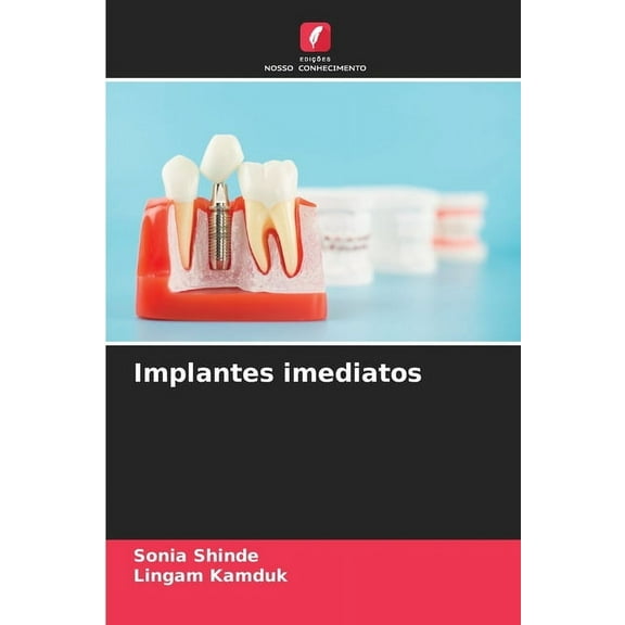 Implantes imediatos, (Paperback)