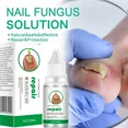 thumbnail image 2 of Hongo fuerte para uñas, cuidado de reparación de uñas, eliminación de hongos para dedos de los pies, antiinfección, nuevo, 2 of 5