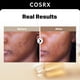 thumbnail image 2 of Sérum COSRX Alpha Arbutin 2% Decolorante Care, 50 ml con niacinamida, 2 of 9
