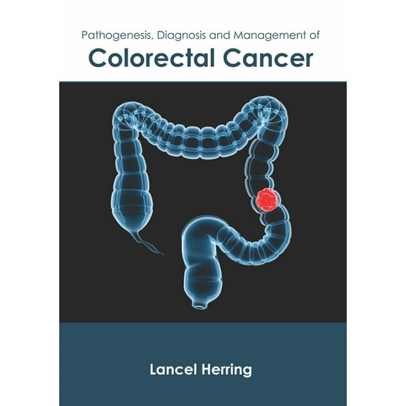 Pathogenesis, Diagnosis and Management of Colorectal Cancer, (Hardcover)