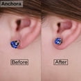 thumbnail image 2 of Earring Backs for Droopy Ears | Earring Lifters for Heavy Earring | Earing Lifter Backs Backs | Earlobe Secure, 2 of 5