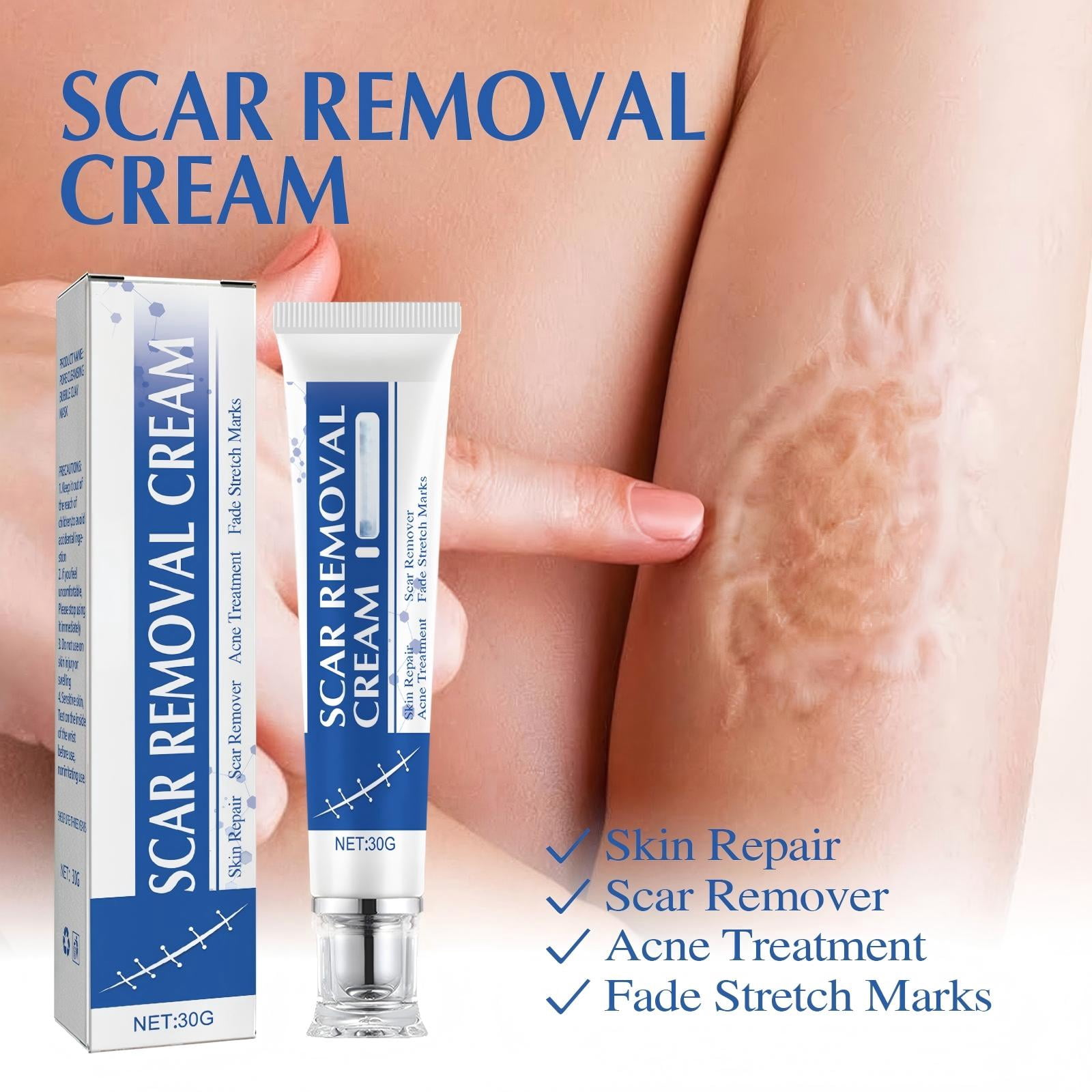 Alvantor Scar Removal Cream, Advanced Scar Gel for Face & Body, Moisturizing and Smooth 1.05oz