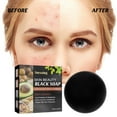 Acne removal and beauty soap for cleaning and suppressing acne on the
