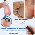 thumbnail image 5 of Kit de manicura para uñas encarnadas, cortauñas, cortauñas gruesas, recortador de pies, lima para uñas de los pies, 5 of 5