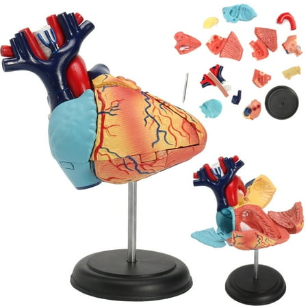 Removable Anatomical Human Life Size Heart Medical Cardiovascular Anatomy Thrombotic Vascular Model 18x14x23cm