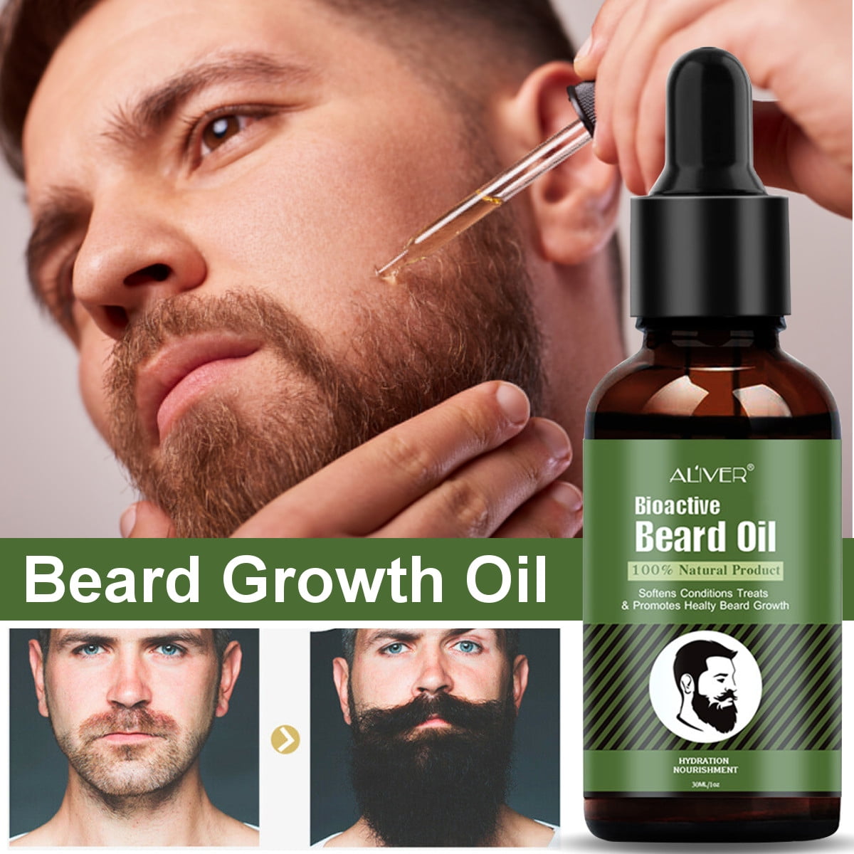100% Natural Plant Beard Oil Hair Growth Essential Oils Hair Mustache Grow  Longer Thicker For Men Grooming | Walmart Canada