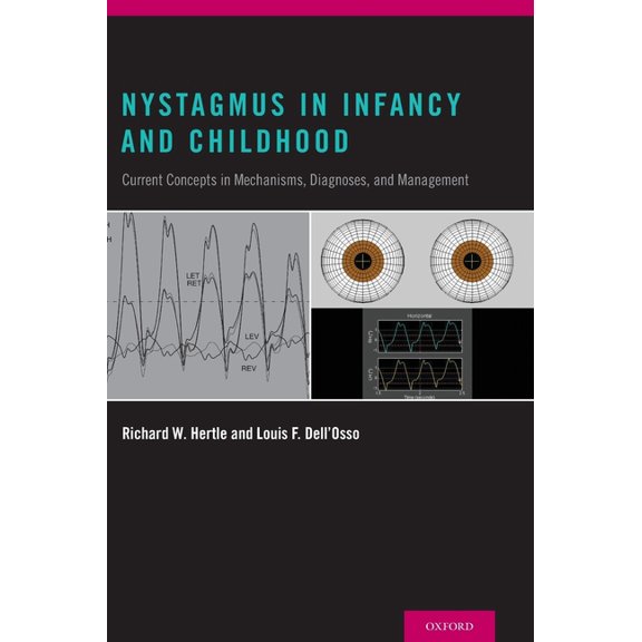 Nystagmus in Infancy and Childhood: Current Concepts in Mechanisms, Diagnoses, and Management, (Hardcover)
