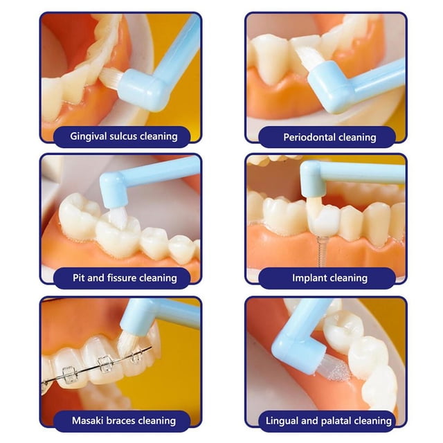 Cepillo interdental Limpieza Cepillo de dientes suave Cuidado bucal (Rosa) Wdftyju Cuidado Belleza
